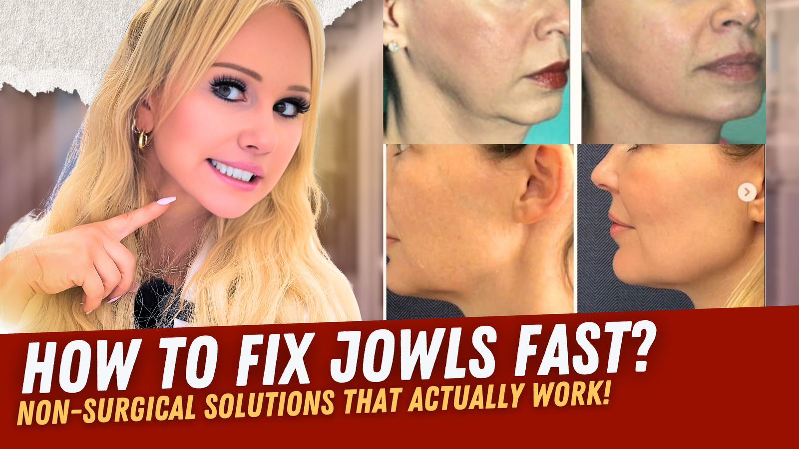 How to Tackle Jowls & Lower Face Laxity Without Surgery